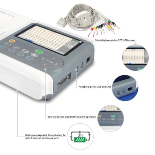 ECG-iE300-2-jpg.jpg Electrocardiograf cu 3 canale, model iE 300